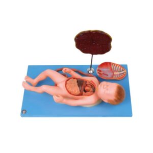 Fetus with Viscus & Placenta
